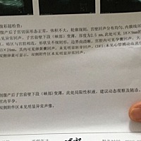 怀孕四十五天，没胎芽，是不是停孕了