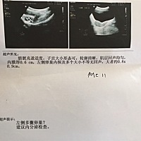 想要宝宝。查的卵泡。这是什么意思？在线等