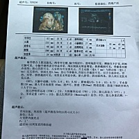 今天刚照的四维，宝宝很配合 躺上去就照了。其实宝宝一直都很心疼我，从怀孕到现在六个月了，没有孕吐过...