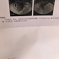 我这个正常吗医生也没有说什么