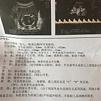 亲爱的宝妈们，帮我看看是男孩还是女孩