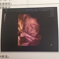 帮我看看这是男宝还是女宝