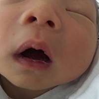 第一胎没经验，出生第七天，宝宝舌头上都是白白的，像奶渍，这是什么，请问需要怎么处理