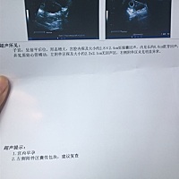 亲们，这样的严重不？问题大不大？有没有一样的。