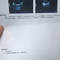 这是什么情况？