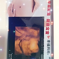 大家帮忙看看，像妈妈还是像爸爸