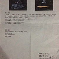 姐妹们有没有谁的NT值刚好是0.3后面没问题的！我姐姐大龄孕妇很是担心！求解🙏