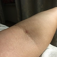 昨天各种纠结，好在有好多可爱的小姐姐一直回复我帖子给我鼓励！给我宽心！再次非常感谢昨天所有评论的...