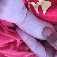 亲们  有没有人知道这个小红点是什么呀