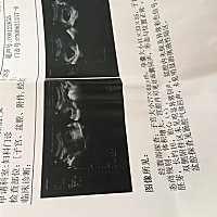 帮忙看下男女，孕囊大小41×33×55是男孩女孩