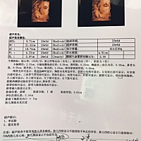 昨天刚做的四维，有没有会看宝宝男女的，帮忙看下，谢谢啦