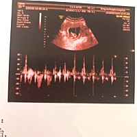 朋友们看一下是男宝还是女宝