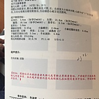 今天刚做的四维，祝大家好运！有没有会看男宝女宝的，非常好奇。希望告知