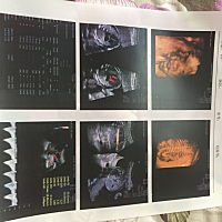 今天做四维彩超  医生笑着说孩子嘴巴张好大  搞笑。请大家帮忙看看是男宝还是女宝