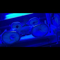 宝宝黄疸17.5 住院治疗照蓝光了，抽了好多血化验 好心疼，还好有效果，治疗黄疸还有什么好办法吗？