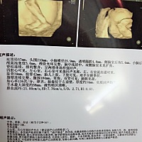 懂的帮我看下男孩女孩，谢谢了