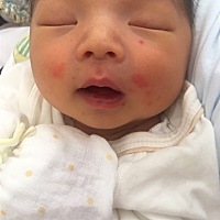 小宝宝出生第八天，这两天脸上长这个，不知道是啥，第一次当妈妈好担心