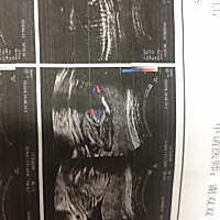这张是不是宝宝双腿啊