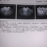 12号b超检测没有优势卵泡，15号b超还是没有优势卵泡，会不会我本身就不会排卵，备孕快半年了，心灰意冷...