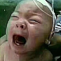 好心酸[流泪][流泪][流泪]有些爱，是最大的伤害！家人喂药💊喂多了 2岁孩子肾衰😱 平时增加孩子的抵...