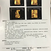 有没有宝妈们会看是男宝女宝呀^_^