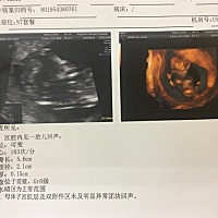 我的NT单子好简单啊，能看得出男女嘛，好好奇，哈哈