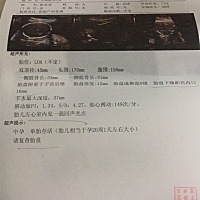 有孕妈跟我情况一样的吗，左心室强回声光点，医生让做无创，好担心呀
