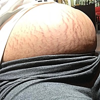 34周了快，肚子上也太花了吧？救命，，，，，抹了妊娠油还是有你们呢？？？