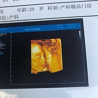 可以看出来男宝宝女宝宝吗