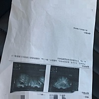 帮忙看看啥时候会排