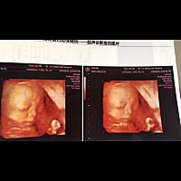 这是才做的四维，大家帮我看看像姑娘还是儿子啊，纯属娱乐呢