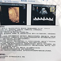 有没有会看单子的？男宝还是女宝