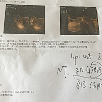 孕7W 做的B超，孕囊尺寸30×26×21，请问男宝or女宝几率大？