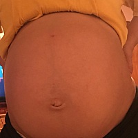 二胎，2018.6.15顺产女宝一枚