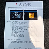 男宝女宝？我老公可好奇了.给宝宝早点娶个好听的名字.买小衣服