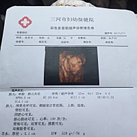 今天照了四维彩超心情好紧张，终于照完了，就说胎儿头部有点偏小，别的都正常，有懂得的宝妈们帮我看看...