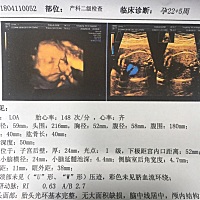 今天做了四维，大家能看出宝宝性别吗