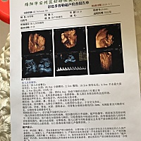 都39周 2天了，一点感觉都没有，宝宝千万不要留级啊，每天是又开心期待宝宝的到来，又紧张害怕痛，纠结...