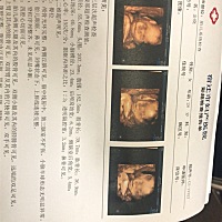 这个可以看出来是男孩还是女孩吗？