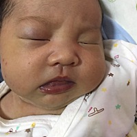 宝宝一个眼睛上火黄色眼屎还有点红色的怎么办！