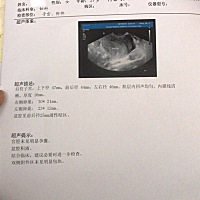 大姨妈推迟了七天，今天验孕棒发现两条线，而且见红了，就去医院，因为是急症，不可以抽血，去检查B超，...