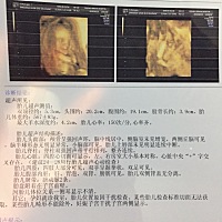 姐妹们四维接好孕啦……有会看数据的吗？男孩还是女孩？