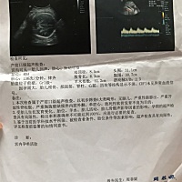 请各位宝妈帮忙看看是男是女