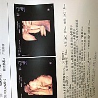 请大姐帮我看看男宝还是女