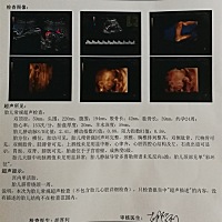 能看出男女不？