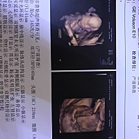 请大家帮忙看看男宝还是女宝