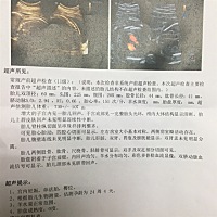 能不能帮我看男女，我准备装修房子了，如果早点知道顺便把孩子的房间装修风格弄好[愉快]