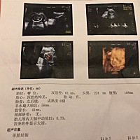 怀孕第六个月做的三维彩超，有看的出来是男孩还是女孩的吗？求解