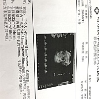 能看出来男孩女孩吗