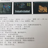 能看出是男孩还是女孩吗？